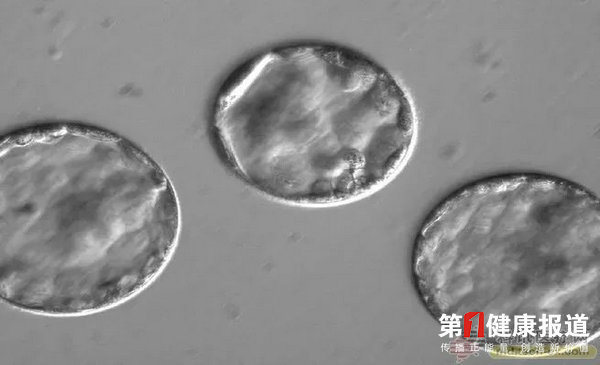 一个很好的治疗方法。图片来源：OHSU.jpg