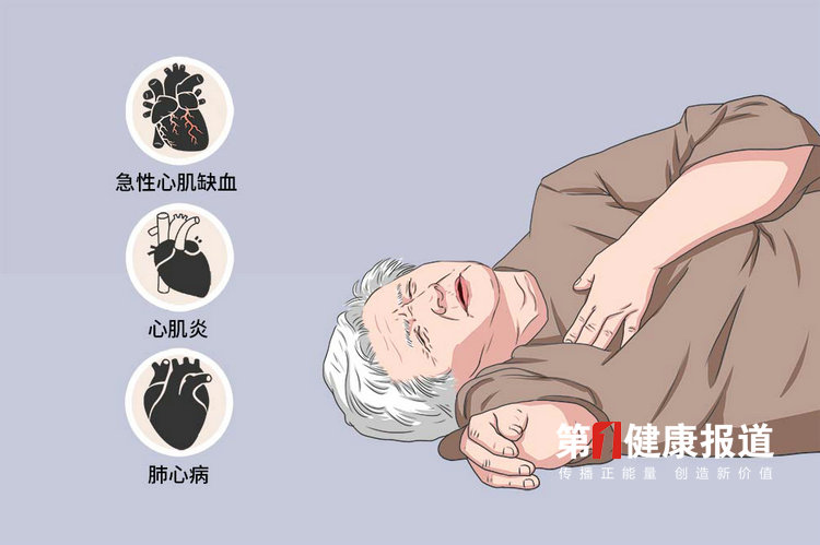 气温忽冷忽热谨防猝死发生