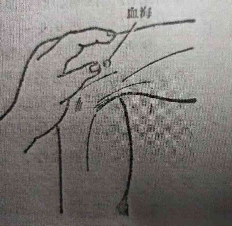 健康人才榜|韩礼：论中医异病同方治疗及其辩证关系.jpg