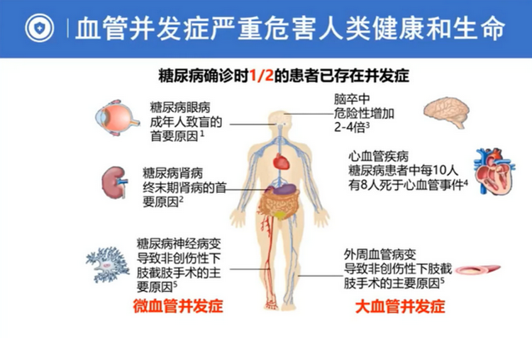 基层医生|糖尿病并发症中药解决之道