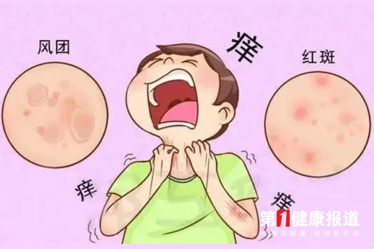 全球麻疹“回潮”需警惕
