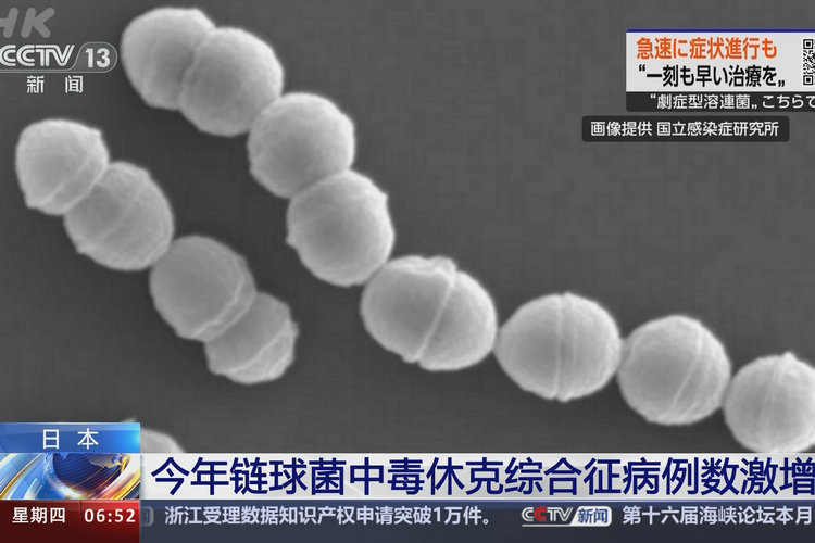 感染几小时可令手脚腐烂，如何预防“食人菌”感染？